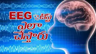 What is EEG Test For Brain (Electroencephalogram) EEG టెస్ట్ అంటే ఏమిటి ? ||@LotusMediaOfficial