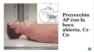 Técnicas II - Proyecciones especiales columna cervical (3ºC Vespertino, Docente Graciela Castillo)