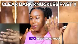 Clear Dark Knuckles Naturally Fast ‼️
