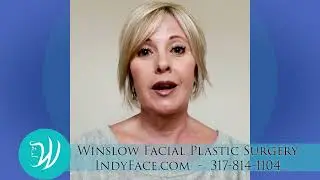 Facelift Experience with Dr. Catherine Winslow in Indianapolis