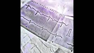 Nada Puede Malir Sal
