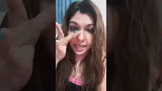 Septoplasty, Turbinate reduction, bone spur removal and balloon sinoplasty experience update #2