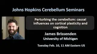 James Brissenden: perturbing the human cerebellum