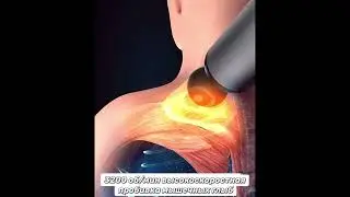Массажер Konka ручной вибрационный