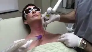 Dr. Seiler uses Fotona Q-Switch Laser for Pigment on Neck & Chest