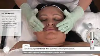 Enhance Your Microneedling Service with Control Corrective