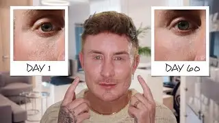 The One Tool That Still Improves My 40+ Skin After HIFU, RF & Lasers