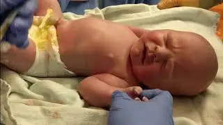 Testing Baby Reflexes | Moro Reflex