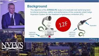 Indigo Thrombectomy   Bret N  Wiechmann  Venous Symposium