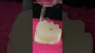 Capping The Tooth #crown #teeth #shorts