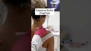 #traptox #trapeziusbotox #botoxtraining #drbitafarrell
