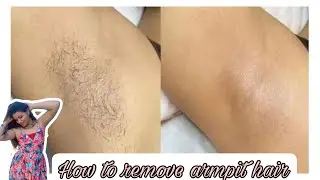 How to Remove underarms Hair | How I remove my armpit hair | underarms hair.