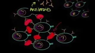 Epstein Barr Virus