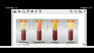 TYPES OF BLOOD SERUM SAMPLES || LAB TECHNICIAN || BMLT || BIOCHEMISTRY || MEDICAL EXPECT