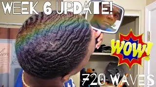 720 Waves|Week 6 update since scalp