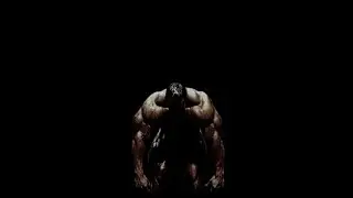 Welcome to the pain zone