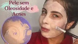 SKINCARE COM ARGILA ROSA- PELE SEM OLEOSIDADE E ACNES.