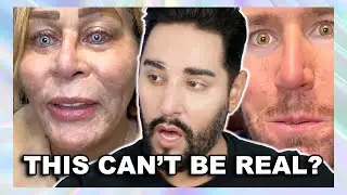 Permanent Eye Color Surgery Gone Very Wrong