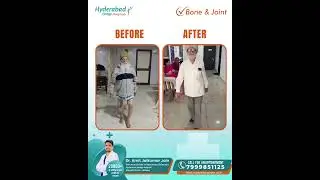 Patient Review | knee replacement surgery | Dr. Amit Jain | Omega Hospital  Jabalpur
