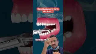 Une dent en moins, un d&eacute;s&eacute;quilibre en plus ?