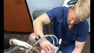 Fraxel Restore Laser Resurfacing