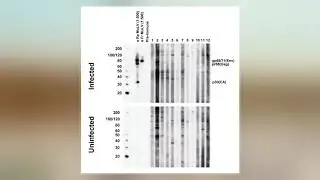 Xenotropic Murine Leukemia Virus-Related Virus