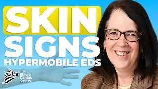 Dr. Clair's Guide to Skin Hyperextensibility: Assessing Skin Involvement, Causes, and Treatment