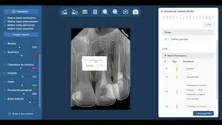 NanoPix - instalación y uso del software
