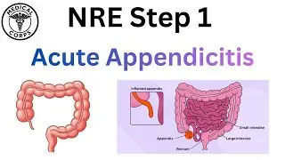 Acute Appendicitis | NRE 1 Preparation By Medical Corps 🩺