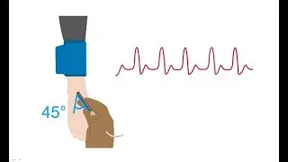 Performing a manual ankle-brachial index (ABI)