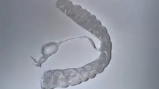 Dental Relaxer Plaque &ndash; Tensile Strength Test (2.8 kg Without Tearing!)