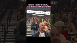 Retrouve des cheveux en 2heures une des meilleures solutions qu&rsquo;il existe pour la calvitie 🔥