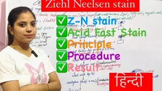 Ziehl Neelsen Stain ॥ (Z-N Stain) ॥Acid Fast Staining ॥ZN Stain ॥Microbiology ॥principle ॥ procedure