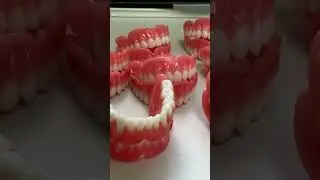 3D-Printed Characteristic Dentures