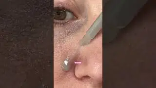 Dr Melaxin rice peel shot is life changing for my skincare routine #drmelaxin #skincareroutine