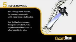 Thingee - Osteotech: FacetLink