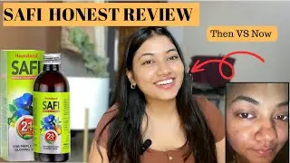 SAFI Honest Review | My Experience with SAFI | Benefits and Side Effects | Pragya Arya