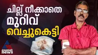 വീണ്ടും അനാസ്ഥ; ചേർത്തലയിൽ ചില്ലുകഷണങ്ങൾ മുറിവ് വച്ചുകെട്ടിയതായി പരാതി | Medical negligence