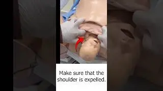 Cardinal Movements of Labor Explained | Obstetric Delivery Simulation