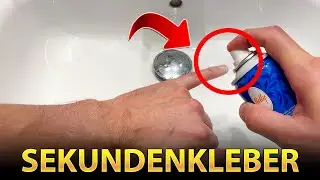 Wie Sekundenkleber RESTE auf der Hand wegbekommen?