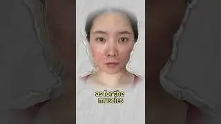 This Is What Happened to Her Face After Facial Contouring Surgery...😻