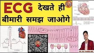 ECG Report | ECG Report Reading | ECG Report kaise Pade | Doctor | Hospital | Nursing | BHMS | BAMS
