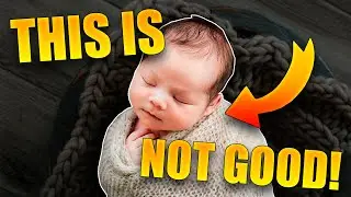 When Should You Start Therapy For Congenital Muscular Torticollis & How Bad Is It?