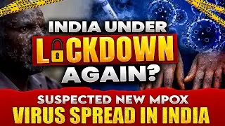 MPOX in India |  Monkeypox virus Detail Explanation | What Causes Monkeypox? #mpox #mpoxvirus