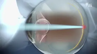 Underwater Vision Human Limits