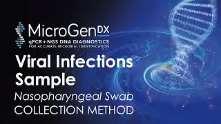 Viral Infections Sample Collection Method Using Nasopharyngeal Swab