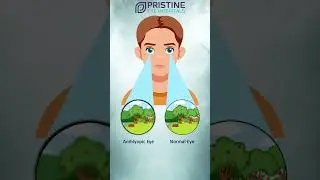 What is Amblyopia (Lazy Eye)? 👁️ Simple Explanation for Parents #pristineeyehospitals #hyderabad