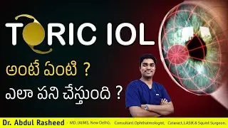 What is Toric IOL? How does it work? | Lenses for Cataract Surgery telugu | Dr Abdul Rasheed