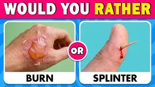 Would You Rather...? 🔥😨 The Most Extreme Choices You&rsquo;ll EVER Face!
