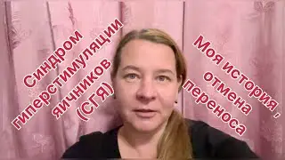Синдром гиперстимуляции яичников (СГЯ) в протоколе ЭКО. Самое частое осложнение. Моя история.